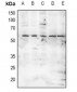 Anti-MNK2 (pT249) Antibody