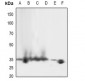 Anti-LAT (pY161) Antibody