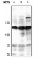 Anti-iNOS (pY151) Antibody
