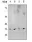 Anti-HP1 alpha (pS92) Antibody
