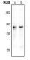 Anti-nNOS (pS1417) Antibody