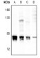 Anti-PKC alpha (pS657) Antibody