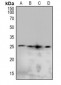 Anti-Caveolin 2 (pY19) Antibody