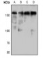 Anti-DAP Kinase 1 (pS736) Antibody