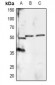 Anti-RXR alpha (pS260) Antibody