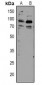 Anti-TORC2 (pS171) Antibody