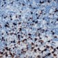 Anti-ETS1 (pS251) Antibody