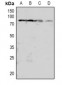 Anti-PKC beta (pT641) Antibody