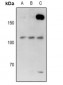 Anti-USP28 Antibody