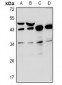 Anti-RNF144B Antibody