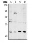 Anti-NEIL1 Antibody