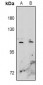 Anti-EPHA10 Antibody