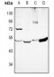 Anti-EIF2S2 Antibody