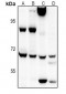 Anti-EIF2AK1 Antibody