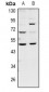 Anti-GDF7 Antibody