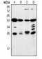 Anti-Mannose Binding Protein Antibody