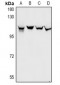 Anti-Gemin3 Antibody