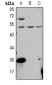 Anti-PPM1L Antibody