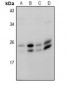 Anti-RAB18 Antibody