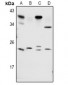 Anti-RAB1B Antibody