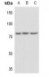 Anti-PLK2 Antibody