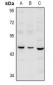 Anti-Serpin B12 Antibody