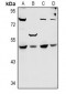 Anti-SYT11 Antibody