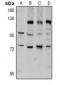 Anti-CD6 Antibody