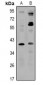 Anti-ZNT8 Antibody