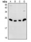 Anti-N4WBP5 Antibody