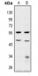 Anti-BRE Antibody