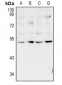 Anti-ZAC Antibody