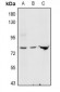 Anti-GNE Antibody