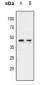 Anti-ZAR1 Antibody