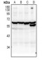 Anti-KLF12 Antibody