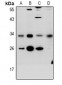 Anti-CD272 Antibody