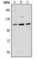 Anti-Desmoglein 1 Antibody