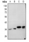 Anti-Cathepsin L Antibody