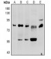 Anti-Factor II Antibody