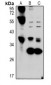 Anti-Hepassocin Antibody