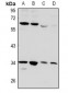 Anti-CD32b Antibody