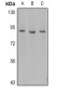 Anti-Myeloperoxidase 89k Antibody