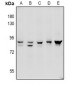 Anti-ADAM10 Antibody