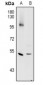 Anti-Cathepsin C HC Antibody