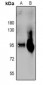 Anti-Plasminogen HC A Antibody