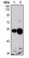 Anti-GPR103 Antibody