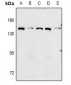 Anti-GPR124 Antibody