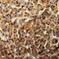 Anti-Amphiphysin 2 Antibody