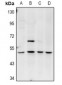 Anti-Amphiphysin 2 Antibody