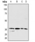 Anti-PDGFC Antibody